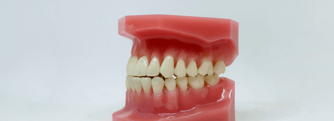 Gum disease, also known as periodontal disease, affects 20% to 50% of older adults (1).  A build-up of dental plaque causes an infection on the gums, leading to periodontal disease. …