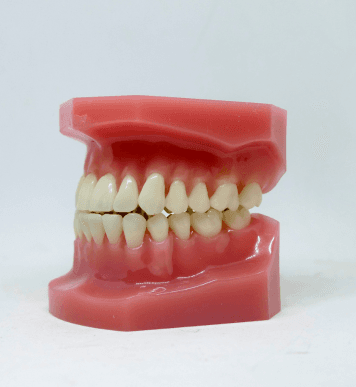 Gum disease, also known as periodontal disease, affects 20% to 50% of older adults (1).  A build-up of dental plaque causes an infection on the gums, leading to periodontal disease. …